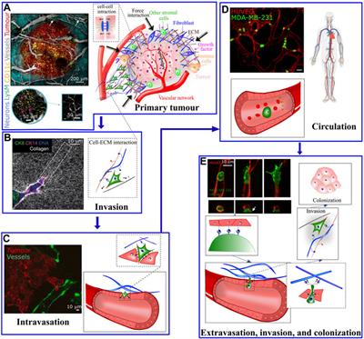 Mechanobiology in oncology: basic concepts and clinical prospects